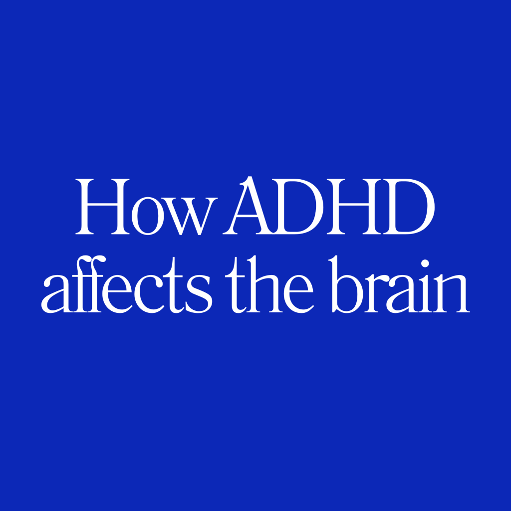 How ADHD Affects The Brain: Insights from Research